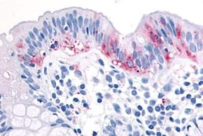 Immunohistochemistry-Paraffin: MAP3K8/Tpl2/COT Antibody [NBP3-14395]